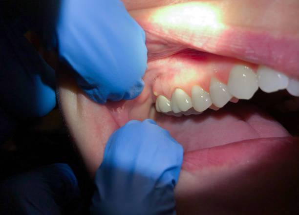Best Walk-In Emergency Dentist in Ballwin, MO