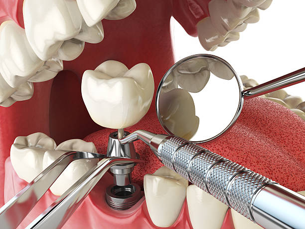 Best Emergency Dental Surgery in Ballwin, MO