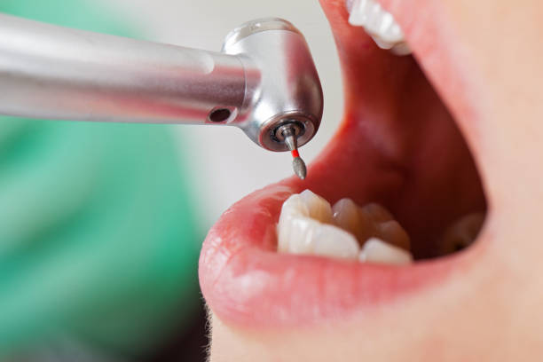 Best Emergency Tooth Extraction in Ballwin, MO
